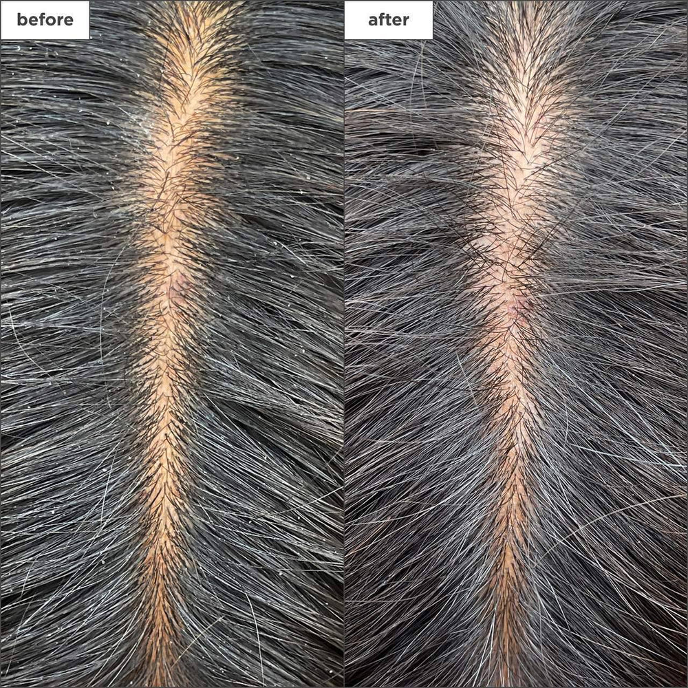 Briogeo Scalp Revival Charcoal + Tea Tree Cooling Hydration Mask for Dry, Itchy Scalp - G13 - 1785